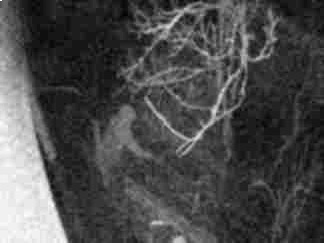 elmosódott éjszakai kamera kép